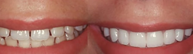 Dentist in Trivandrum – Dr. Kashi Vishwanath