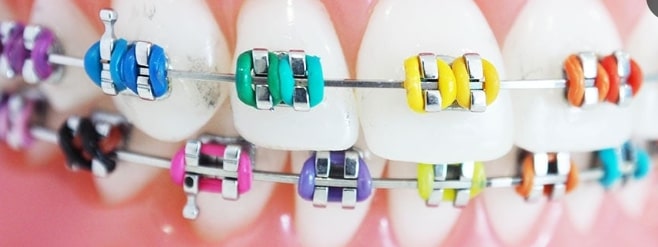 Dentist in Trivandrum – Dr. Kashi Vishwanath