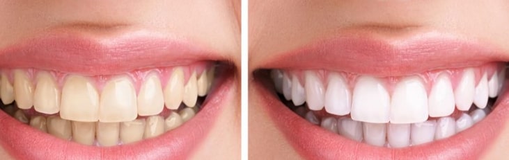 Dentist in Trivandrum – Dr. Kashi Vishwanath